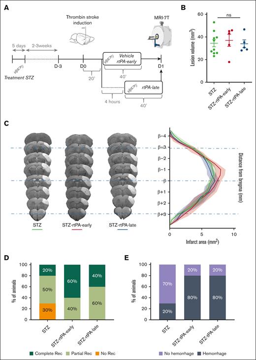 Chronic hyperglycemia induces rtPA resistance and increases HT independently of the therapeutic window. (A) Schematic representation of the experimental protocol. (B) Quantification of ischemic lesion volume, 24 hours after MCAo assessed by T2-weighted imaging (7T MRI) in hyperglycemic mice treated with saline (STZ group) or rtPA (10 mg/kg; Actilyse, 10% bolus, 90% perfusion during 40 minutes), in early 20 minutes after MCAo (STZ-rtPA-early) or in late 4 hours after MCAo (STZ-rtPA-late). Individual values, means, and SEM are plotted; 34.45 mm3 for STZ group (n = 10); 37.01 mm3 for STZ-rtPA-early group (n = 5); and 33.98 mm3 for STZ-rtPA-late group (n = 5). Ordinary 1-way ANOVA (P = .14). (C) Representative T2-weighted 7T MRI brain images (left) and representation of the lesion distribution around bregma (right) 24 hours after MCAo in STZ, STZ-rtPA-early and STZ-rtPA-late groups. (D) Percentage of angiographic scores, 24 hours after MCAo assessed by FLASH_TOF_2D imaging (7T MRI) in STZ (n = 10), STZ-rtPA-early (n = 5), and STZ-rtPA-late (n = 5) groups. No recanalization = complete occlusion (orange); partial recanalization = incomplete filling of the distal bed (light green); and complete recanalization = complete filling of the distal bed (dark green). Kruskal-Wallis test (P = .16). (E) Proportion of HT per group, 24 hours after MCAo assessed by T2∗-weighted imaging (deoxyhemoglobin; 7T MRI) in STZ (n = 10), STZ-rtPA-early (n = 5), and STZ-rtPA-late (n = 5) groups. Fisher exact tests between groups (P > .05).