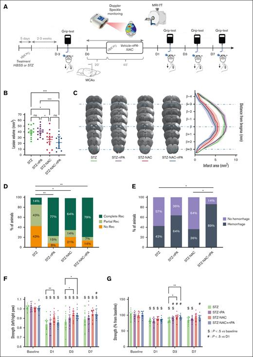 N-Acetyl-Cysteine induces recanalization after acute thrombosis in chronically hyperglycemic animals without risk of HT. (A) Schematic representation of the experimental protocol. (B) Quantification of ischemic lesion volume 24 hours after MCAo assessed by T2-weighted imaging (7T MRI) in hyperglycemic mice treated after stroke with saline (STZ) or rtPA (10mg/kg; Actilyse, 10% bolus, 90% perfusion during 40 minutes; STZ-rtPA group), NAC (400 mg/kg, slow bolus during 60 seconds; STZ-NAC group) or a combination of NAC and rtPA (STZ-NAC-rtPA group). 40.20 mm3 for STZ group (n = 14); 40.43 mm3 for STZ-rtPA group (n = 14); 26.92 mm3 for STZ-NAC group (n = 14); 21.59 mm3 for STZ-NAC-rtPA group (n = 14). Ordinary one-way ANOVA (P < .001); Tukey test for multiple comparisons (∗P < .05; ∗∗∗P < .001). (C) Representative T2-weighted 7T MRI brain images (left) and representation of the lesion distribution around bregma (right) 24 hours after MCAo in STZ, STZ-rtPA, STZ-NAC and STZ-NAC-rtPA groups. (D) Percentage of angiographic scores 24 hours after MCAo assessed by FLASH_TOF_2D imaging (7T MRI) in STZ, STZ-rtPA, STZ-NAC and STZ-NAC-rtPA groups (n = 13-14 per group). No recanalization = complete occlusion (orange); partial recanalization = incomplete filling of the distal bed (light green); complete recanalization = complete filling of the distal bed (dark green). Kruskal-Wallis test (P < .01); Dunn’s test for multiple comparisons (∗P < .05, ∗∗P < .01). (E) Proportion of HT per groups 24 hours after MCAo assessed by T2∗-weighted imaging (deoxyhemoglobin; 7T MRI) in STZ, STZ-rtPA, STZ-NAC and STZ-NAC-rtPA groups (n = 14 per group). Fisher exact tests between groups (∗P < .05). (F) Quantification of the specific left paw strength deficit measured by grip-test ratio (strength of left/right paws) on day before and on day 1, day 3, and day 7 after MCAo in STZ, STZ-rtPA, STZ-NAC and STZ-NAC-rtPA groups (n = 14 per group). Data were assessed in grams. Results are represented in mean ± SEM. 2-way ANOVA: Time factor <0.0001 and group factor <0.001; Tukey test for multiple comparison (∗P < .05 between groups at each time; $P < .5 vs baseline for each group: impact of Stroke; #P < .5 vs day 1 for each group: recovery). (G) Quantification of the global strength deficit measured by grip-test of forepaws before and on days 1, 3, and 7 after MCAo in STZ, STZ-rtPA, STZ-NAC and STZ-NAC-rtPA groups (n = 14 per group). Data were assessed in grams and converted in percentage normalized for each animal with the corresponding baseline value (before MCAo). Results are represented in mean ± SEM. 2-way ANOVA: Time factor <0.0001 and group factor <0.001; Tukey test for multiple comparison (∗P < .05 between groups at each time; $P < .5 vs baseline for each group: impact of Stroke; #P < .5 vs day 1 for each group: recovery).