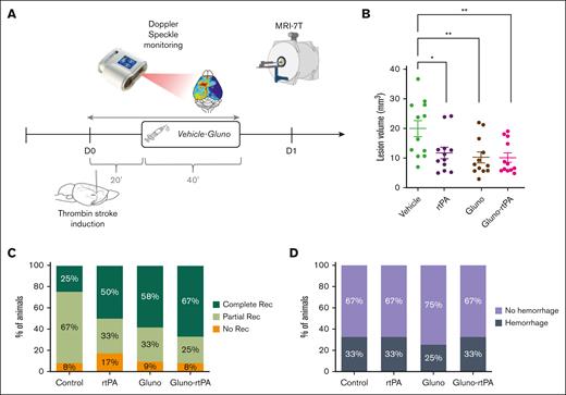 Targeting endothelial tPA-dependent NMDAR signaling with Glunomab increases the benefit of rtPA-mediated thrombolysis in nonhyperglycemic mice. (A) Schematic representation of the experimental protocol. (B) Quantification of ischemic lesion volume, 24 hours after MCAo assessed by T2-weighted imaging (7T MRI) in mice treated with saline (vehicle group), rtPA (10 mg/kg; Actilyse, 10% bolus, 90% perfusion during 40 minutes; rtPA group), Glunomab (300 μg, 100% bolus; Gluno group), or a combination of Glunomab-rtPA (Gluno-rtPA group). Individual values, means and SEM are plotted. 21.57 mm3 for vehicle group (n = 12); 12.07 mm3 for tPA group (n = 12); 10.26 mm3 for Gluno group (n = 12); and 11.04 mm3 for Gluno-rtPA group (n = 12). Ordinary 1-way ANOVA (P < .001); Tukey test for multiple comparisons (∗P < .05 and ∗∗P < .01). (C) Percentage of angiographic scores, 24 hours after MCAo assessed by FLASH_TOF_2D imaging (7T MRI) in vehicle, rtPA, Gluno, and Gluno-rtPA groups (n = 12 per group). No recanalization = complete occlusion (orange); partial recanalization = incomplete filling of the distal bed (light green); and complete recanalization = complete filling of the distal bed (dark green). Kruskal-Wallis test (P = .33). (D) Proportion of HT per group, 24 hours after MCAo assessed by T2∗-weighted imaging (deoxyhemoglobin; 7T MRI) in vehicle, rtPA, Gluno, and Gluno-rtPA groups (n = 12 per group). Fisher exact tests between groups (P > .05).
