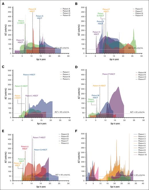 Patterns of ALT variation in patients with FA with PLI. Changes in ALT in patients with FA with PLI are graphed and shown. Four patients are shown per graph for ease of comparison. The average of 3 values for ALT (U/mL) were used to graph these values against the patient’s age in years using a fourth-order smoothing polynomial. (A-E) ALT changes in each patient with FA who underwent HSCT and met criteria for PLI. The area under the curve is shaded for each patient and the time of stem cell infusion in recipients of HSCT are noted. (F) ALT changes in patients with PLI who did not receive HSCT.