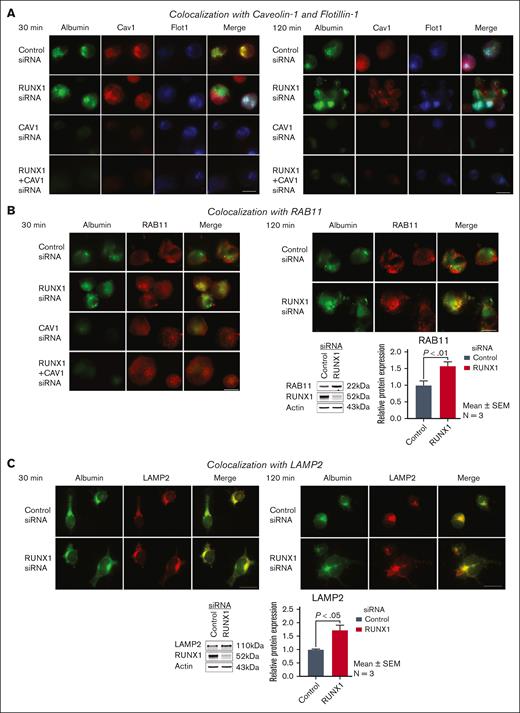 Effect of siRNA KD of RUNX1, CAV1, or both on albumin colocalization with Cav1, Flot1, RAB11, and LAMP2 in HEL cells by immunofluorescence microscopy. (A) Representative images showing the effect of KD of RUNX1 or CAV1 alone or in combination on albumin colocalization with Cav1 and Flot1. Control cells and those with siRNA KD of RUNX1, CAV1, or the combination were incubated with 30 μg/mL albumin Alexa 488 for 30 and 120 minutes, fixed and immobilized on poly-L-lysine-coated coverslips. Albumin is shown in green fluorescence. HEL cells were additionally stained with anti-Cav1 (red) or anti- Flot1 (blue) antibodies to assess colocalization as seen in merged images, evaluated by Epifluorescence microscope (EVOS FL Autoimaging). Because HEL cells had minimal endogenous Cav1, it was enhanced to assess colocalization with albumin. At 30 minutes, in control cells albumin (green) was colocalized with Cav1 (red), as shown in yellow in merged images, but not with Flot1 (blue). With RUNX1 KD, albumin colocalization with Cav1 was decreased with increased colocalization with Flot1. With CAV1 KD alone no albumin was discernible. At 120 minutes, with RUNX1 KD there was a decrease in albumin colocalization with Cav1 and an increase with Flot1. (B) Representative images showing the effect of KD of RUNX1 or CAV1 alone or in combination on albumin (green) colocalization with RAB11 (red), a marker for recycling endosomes. At 30 or 120 minutes, there was low colocalization of albumin (green) with RAB11 (red) in control cells or on RUNX1 KD. On CAV1 KD alone or together with RUNX1 KD there was negligible albumin in the cells. Representative immunoblots showing RAB11, RUNX1, and actin levels and densitometric quantification are shown. Data are shown as mean ± SEM (n = 4). (C) Representative images showing the effect of KD of RUNX1 or CAV1 alone or in combination on albumin (green) colocalization with lysosomal marker LAMP2 (red). At 30 minutes, there was some colocalization of albumin with LAMP2 in control cells and on RUNX1 KD. At 120 min the colocalization of albumin with LAMP2 appeared more prominent with RUNX1 KD than in control cells. Representative immunoblot showing protein expression of LAMP2, RUNX1, and actin, and densitometric quantification. Shown as mean ± SEM (n = 3).