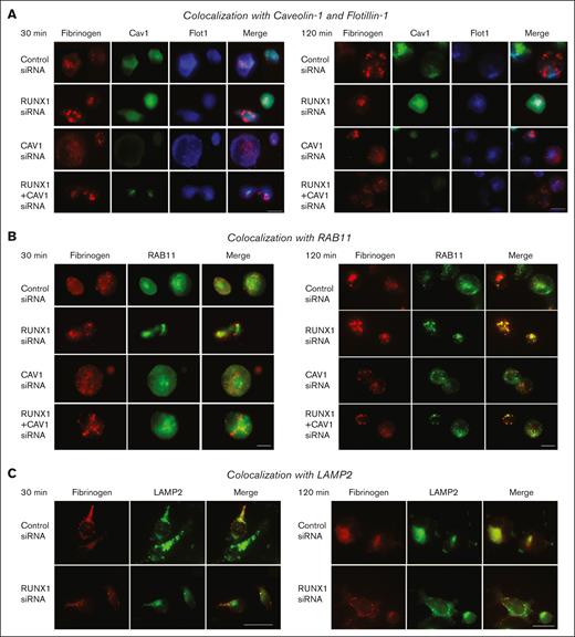 Effect of siRNA KD of RUNX1, CAV1, or both on fibrinogen colocalization with Cav1, Flot1, RAB11, and LAMP2 in HEL cells by immunofluorescence microscopy. (A) Representative images showing the effect of KD of RUNX1 or CAV1 alone or in combination on fibrinogen colocalization with Cav1 and Flot1. The experimental design was same as in Figure 4. HEL-cell suspensions (control cells and those with siRNA KD of RUNX1, CAV1, or combination) were incubated with fibrinogen Alexa 647, fixed, and immobilized on poly-lysine-coated coverslips. HEL cells were additionally stained with anti-Cav1 (green) or anti-Flot1 (blue) antibodies to assess colocalization as seen in merged images, evaluated by Epifluorescence microscope (EVOS FL Autoimaging). Because HEL cells had minimal endogenous Cav1, it was enhanced to assess colocalization with albumin. At 30 and 120 minutes, in control cells fibrinogen (red) showed no colocalization with Cav1 (green) or with Flot1 (blue). With CAV1 KD alone fibrinogen uptake was unaffected compared to control cells. (B) Representative images showing the effect of KD of RUNX1, CAV1 KD, or the combination on fibrinogen (red) colocalization with RAB11 (green), a marker for recycling endosomes. At 30 minutes, there was low to moderate fibrinogen colocalization (merged images, yellow) with RAB11 in control cells, and this was increased with RUNX1 KD and with KD of RUNX1+CAV1 (left panel); the colocalization with RAB11 was more prominent at 120 minutes (right panel). (C) Representative images showing the effect of KD of RUNX1 or CAV1 KD alone or in combination on colocalization of fibrinogen with lysosomal marker LAMP2 (green). At 30 (left panel) or 120 (right panel) minutes, there was similar low colocalization of fibrinogen (red) with LAMP2 (green) in control cells or on RUNX1 KD.