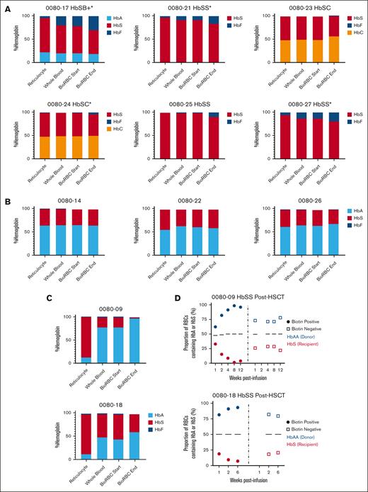 Change in hemoglobin content in surviving BioRBCs compared with whole blood. (A) Change in % sickle, fetal, or C hemoglobin as performed by high performance liquid chromatography in the participants with SCD pretransplant in reticulocytes, whole blood, and the biotin-positive fraction sorted by flow cytometry at the time of product infusion and near the end of the RBC lifespan. (B-C) Change in % sickle or adult hemoglobin in the participants with SCD who underwent HSCT and had full DMC (B) or mixed chimerism (C). (D) Single cell Western analysis demonstrating single cell proportion of HbA to HbS of the biotin-positive fraction after sorting compared to the biotin negative fraction on the 2 participants with HbSS post-HSCT with mixed donor chimerism. ∗Participants on HU.