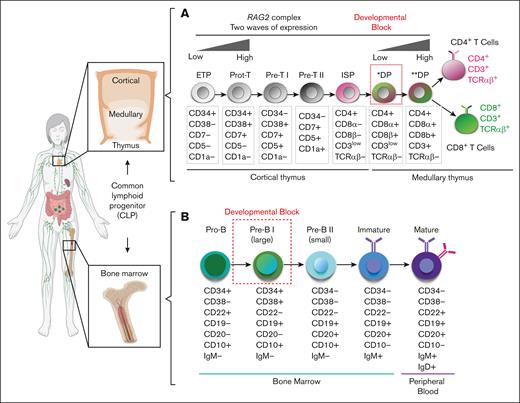 Schematics of hematopoietic developmental defect for patients with RAG2-SCID. (A) Overview of human T-cell (top) and (B) B-cell (bottom) developmental stages in the thymus and BM from cCLP. Dotted red squares mark developmental block for patients with RAG2-SCID. ∗DP, preselection double-positive stage; ∗∗DP, postselection double-positive stage; ETP, early thymic progenitor; ISP, immature single-positive stage.