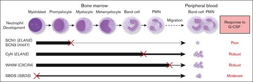 Correlation between the stage and severity of neutrophil development impairment and responsiveness to G-CSF therapy. SCN1 and SCN3, which display a severe maturation arrest at an early stage (between promyelocyte and myelocyte) during BM neutrophil development, show a poor response to G-CSF. CyN, WHIM, and SBDS, where BM neutrophil development is disrupted at a late stage, unaffected, or partially interrupted, respond well to G-CSF therapy. An ‘×’ indicates a developmental block or migration defect; The line thickness reflects the degree of normal neutrophil development.