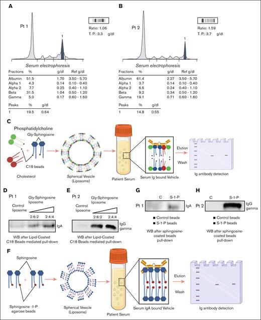 Specific binding of clonal immunoglobulins to Gaucher lysolipids. (A-B) Serum protein electrophoresis (SPEP) for patient 1 and patient 2 highlighting a monoclonal protein peak in the beta 2 and the gamma regions, respectively. (C) A schematic representation of the protein pull-down process using lipid-coated C18 beads from patient serum. (D) Western blot analysis demonstrating the binding of monoclonal IgA to lipid-coated C18 beads for patient 1. (E) Western blot analysis demonstrating binding of monoclonal IgG (gamma) for patient 2. The lipids cholesterol, phosphatidylcholine (PC), and Gly-sphingosine were used at the following ratios (w:w): cholesterol/PC (2:4) for control liposomes and cholesterol/PC/Gly-sphingosine (2:6:2 or 2:4:4) for Gly-sphingosine-containing liposomes. (F) A schematic depicting the sphingosine-coated beads pull-down assay from patient serum. (G-H) Western blot analyses demonstrating specific binding of immunoglobulin IgA to sphingosine-coated beads (S-1-P) for patient 1 and IgG (gamma) for patient 2, respectively. Blocked agarose beads were used as a negative control (C) with lipid-coated beads. Illustrations for schematic representations (C) and (F) were created with BioRender.com.