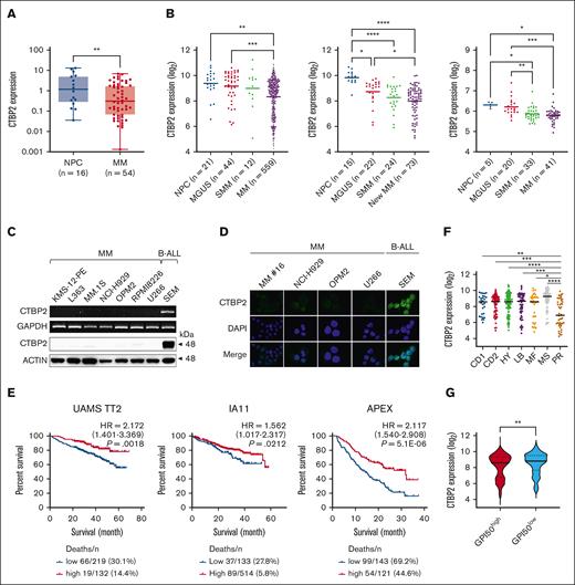 CTBP2 expression and prognostic relevance in MM. (A) CTBP2 expression in normal plasma cells (NPC) and newly diagnosed Chinese patients with MM was detected by real-time quantitative polymerase chain reaction using a custom TaqMan assay for CTBP2. GAPDH served as the control. (B) Expression of CTBP2 using probe set 210554_s_at in NPC, patients with monoclonal gammopathy of undetermined significance (MGUS), smoldering MM (SMM), and MM from microarray data sets (left, combined GSE2658 and GSE5900; middle, GSE6477; right, GSE47552). Statistical significance of differences was determined using 1-way analysis of variance (ANOVA) with Tukey multiple comparison test. (C) Transcript and protein expression of CTBP2 in HMCLs were examined by semiquantitative reverse transcription polymerase chain reaction (upper) and immunoblotting (lower). The B-ALL cell line SEM was used as a positive control. GAPDH and β-actin served as the control, respectively. (D) Immunofluorescence analysis showing the expression and sublocalization of CTBP2 protein in MM cell lines and patient (16) MM cells (400× original magnification). As in panel C, SEM cells were used as positive control. The cells were counterstained with DAPI (4′,6-diamidino-2-phenylindole) for nuclear visualization. (E) Kaplan-Meier analyses showing the prognostic relevance of CTBP2 expression on OS in newly diagnosed patients with MM: UAMS TT2 cohort (GSE2658), MMRF CoMMpass trial IA11 release, and relapsed patient cohort with MM: APEX Trial (GSE9782) using the log-rank test. The optimal cutoff was determined using Cutoff Finder. (F) Dot plot showing median CTBP2 expression among the 7 molecular subgroups in the TT2 cohort. (G) Dot plot showing CTBP2 expression based on GPI-50 gene proliferation index in the TT2 cohort. MMRF, Multiple Myeloma Research Foundation.