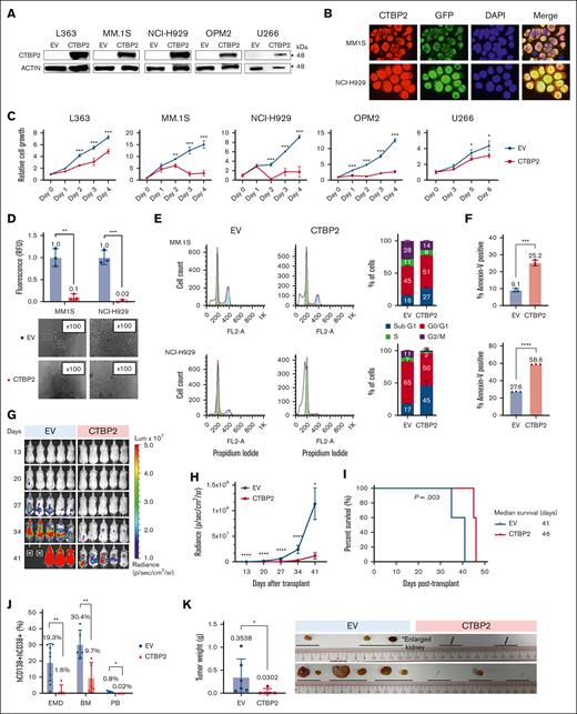 Restoration of CTBP2 elicits antimyeloma activity in vitro and in vivo. HMCLs were transduced with GFP empty vector control (EV) or CTBP2-overexpressing vector (CTBP2). Three days after transduction was assigned as day 0 for subsequent functional studies. (A) Stable overexpression of CTBP2 was confirmed using immunoblotting. β-actin served as the internal control. (B) Immunofluorescence study of transduced HMCLs showing nuclear sublocalization of GFP-tagged CTBP2 protein (red) and counterstained with DAPI. Original magnification, 100×. (C) Analysis of cell proliferation using WST-1 analysis at the indicated time points. Cell growth relative to day 0 is presented. (D) Cells were seeded into semisolid methylcellulose medium and cultured for 7 days. Colony-forming ability relative to EV was determined (upper). Representative images of colony morphology under light microscope (lower). (E) Cell cycle distribution in CTBP2-transduced MM.1S and NCI-H929 cells was assessed by propidium iodide (PI) staining. Representative images of cell cycle distribution (left) and statistical analysis of percentages of cells in the Sub G1, G0/G1, S, and G2/M phases (right) are shown. (F) The percentage of cell death in MM.1S (top) and NCI-H929 (bottom) was measured on day 4 using annexin V staining assay. In panels C-F, results are expressed as mean ± standard deviation (SD) of triplicate measurements from at least 3 independent experiments. (G-K) NCI-H929 cells transduced with EV or CTBP2 were injected IV into NSG mice. (G) Bioluminescence imaging (BLI) was performed at the indicated time points and was adjusted to the same scale. (H) Myeloma burden as quantified by BLI in radiance. (I) Survival analysis using the log-rank test. (J) Detection of myeloma load 35 to 41 days after transplantation. The level of myeloma cells in xenografted animals was evaluated by hCD138 and hCD38 staining. (K) Presence of extramedullary plasmacytomas (EMD) and an enlarged kidney found during harvesting. Tumor images and quantification of tumor weight are shown.∗P < .05; ∗∗P < .01; ∗∗∗P < .001; ∗∗∗∗P < .0001; ns, not significant.