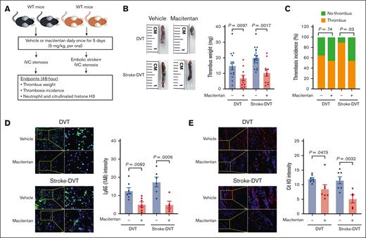 Macitentan pretreatment reduces poststroke DVT severity. (A) Schematic of experimental design. (B) Representative IVC thrombus harvested 48 hours after stenosis from each group (left); and thrombus weight (mg; right). Only mice that exhibited thrombosis were included to quantify the thrombus weight. Each dot represents a single mouse. (C) Thrombosis incidence. (D) Representative cross-sectional immunofluorescence image (left) of the isolated IVC IVC thrombus (48 hours after stenosis) from each group for Ly6G (neutrophils, green) and DAPI (blue). magnification, 20×; scale bar, 50 μm; and quantification (right). (E) Representative cross-sectional immunofluorescence image (left) of the isolated IVC thrombus (48 hours after stenosis) from each group for the antihistone H3 (citrulline R2 + R8 + R17) (NETs, red) and DAPI (blue); magnification, 20×; Scale bar, 50 μm; and quantification (right). Data are mean ± SEM and analyzed by repeated measures ANOVA followed by the corrected method of Benjamini and Yekutieli (B,D,E) or Fisher exact test (C); n = 20 (B-C); and n = 5-6 (D-E). DAPI, 4',6-diamidino-2-phenylindole.