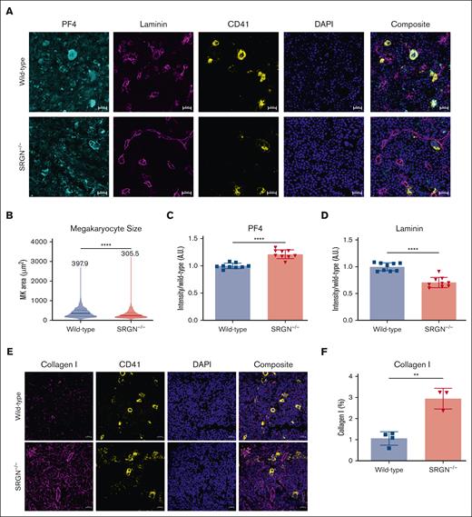 SRGN–/– mice have smaller MKs, increased PF4, and altered basement membrane protein levels. (A) Representative images of femur bone marrow from mice (aged 52 weeks). PF4 (cyan), Laminin (purple), CD41 (yellow), and DAPI (blue). The scale bar represents 20 μm. (B) MK size as determined by the size of CD41 stained cells. Bones from 9 individual mice were evaluated per group. The data shown are representative of the distribution of individual cell areas from each animal (WT, n = 2050; SRGN–/–, n = 2901). (C) Quantification of PF4 fluorescence intensity normalized to background fluorescence within each image and displayed as a ratio to WT average intensity. Each point represents an individual mouse (n = 9). (D) Quantification of laminin fluorescence intensity normalized to background fluorescence within each image and displayed as a ratio to WT average intensity. Each point represents an individual mouse (n = 9). (E) Representative images of femur bone marrow from mice (aged 52 weeks). Collagen I (purple), CD41 (yellow), and DAPI (blue). The scale bar represents 20 μm. (F) Quantification of collagen I–positive area within each image in panel F. Each point represents an individual mouse (n = 9). Significance: ns is indicated by P > .05; ∗P ≤ .05; ∗∗P ≤ .01; ∗∗∗P ≤ .001; ∗∗∗∗P ≤ .0001. All error bars represent the SEM.