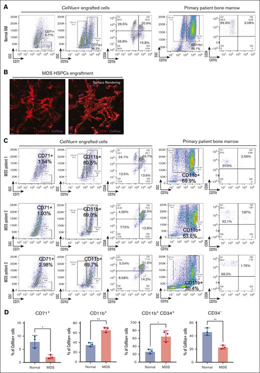 Donor HSPCs engraftments recapitulate disease pathophysiology. (A) Flow cytometry analyses show multilineage differentiation within organoids of CellVue-labeled donor HSPCs. Each organoid was engrafted with 5 × 10³ CD34+ HSPCs derived from a normal bone marrow sample. Ten organoids were pooled for each assay. The patient’s primary bone marrow sample was analyzed, as shown on the right panels, to confirm that the CD34+ cells do not coexpress lineage markers. The percentages of the indicated populations are presented. (B) 3D imaging reveals HSPCs from the bone marrow samples of a patient with MDS engraft within the vascular niches of the organoids. (C) Same as panel A, except that CD34+ HSPCs derived from 3 different patients with MDS were engrafted separately. (D) Statistical analysis of CellVue+ engraftments, with each point representing an independent flow cytometry assay using CD34+ HSPCs from a distinct patient sample. Ten organoids were pooled for each assay. n = 3 in each group. Student t test, ∗P < .05; ∗∗P < .01.