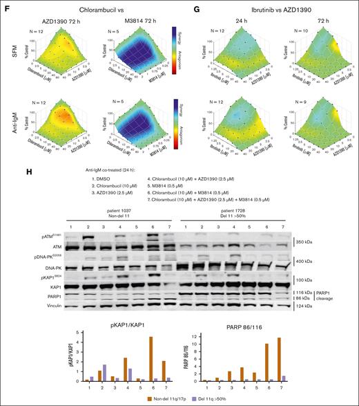 Influence of ATM inhibition and ibrutinib on cell death in CLL or normal B cells. (A) Western blot showing the effects of the ATMis on pATM and pKAP1 and inhibition of pBTK by ibrutinib. Cells were treated for 24 hours in serum-free media (SFM). (B) Survival curves for ibrutinib and the ATMis against CLL and normal B cells, incubated for 24 hours in SFM or with anti-IgM. Cytotoxicity was measured by annexin V/7-aminoactinomycin D staining and flow cytometry. (C) Effective concentration to reduce cell survival by 50% (EC50) for the ATMis and ibrutinib after incubating CLL cells in SFM and with anti-IgM for 24 hours. (D) Correlation between the cytotoxicities of the ATMis and ibrutinib in CLL cells. Data derived from panel C. (E) Comparison of the EC50s in non-del11q and del11q (>50% cells with deletion) CLL samples. (F) Combenefit synergy plots of CLL cells incubated in SFM or with anti-IgM and exposed to chlorambucil (CLB) and AZD1390 or M3814 for 72 hours. (G) Combenefit synergy plots of CLL cells incubated in SFM or anti-IgM and exposed to ibrutinib and AZD1390 for 24 or 72 hours. (H) Western blot of del11q and non-del11q samples incubated for 24 hours with anti-IgM and treated with CLB and AZD1390 (ATMi), M3814 (DNA-PKi), or both. DMSO, dimethyl sulfoxide; ns, not significant.