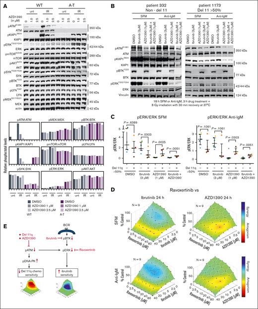 Protein expressions in del11q and non-del11q cells, with and without irradiation, and the interaction of ravoxertinib with AZD1390 and ibrutinib. (A) Western analysis of human B cells derived from individuals without (control) and with ataxia-telangiectasia (A-T; compound inactivating mutations in ATM exon 4) cotreated with AZD1390 and 8 Gy irradiation. AZD1390 reduced pATMS1981 and pKAP1S824 formation in control cells, whereas AZD1390 did not affect other B-cell–specific signaling pathways (mTOR, BTK, ERK, AKT, SYK, and LYN) in control/wild-type (WT) and A-T cells. Interestingly, genetic loss of ATM resulted in alterations to mTOR, SYK, and ERK activity, independent of AZD1390 treatment. (B) Western analysis of CLL cells from a representative non-del11 case and a del11q case (>50% cells effected) following incubation ex vivo for 18 hours in SFM or with anti-IgM, 3-hour drug treatment + 8 Gy irradiation with 30 minute recovery at 37°C. (C) Expression of pERK in 7 non-del11q/del17p cases and 5 del11q cases obtained by densitometry from western analysis in panel B, showing a trend toward decreased pERK in del11q cases coinciding with decreased pATM and pKAP1 (supplemental Figure 6). (D) Ibrutinib (synergism) or AZD1390 (antagonism) cotreatment with ravoxertinib on CLL cell survival. Combenefit plots represent data combined from 9 independent cells from patients with CLL. (E) Postulated mechanisms to explain the chemotherapy resistance, more rapid disease progression, and sensitivity to ibrutinib in del11q CLL. DMSO, dimethyl sulfoxide; IR, irradiation; unt, untreated.