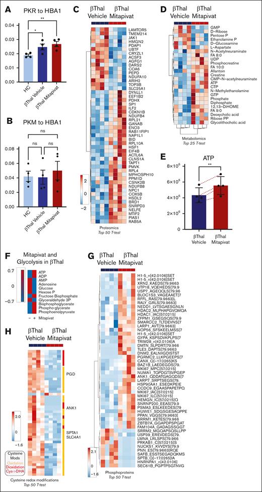 In vitro, mitapivat ameliorates the metabolic and proteomic profiles of human β-thal erythroblasts, associated with decreased overall cysteine oxidation and downregulation of HSP70 expression. PK isoforms PKLR (A) and PKM (all proteoforms) (B) in β-thal erythroblasts as a function of mitapivat treatment. (C) Top 50 proteins (by t test) affected by mitapivat treatment in β-thal erythroblasts (see also supplemental Figure 9). (D) The heat map shows the metabolites that were significantly (t test) affected by mitapivat treatment of β-thal erythroblasts. (E) A detail of ATP, increasing significantly upon mitapivat treatment. (F) Overview of adenylate pools and glycolysis (group averages) in β-thal erythroblasts in the presence or absence of mitapivat (blue vs red indicates low vs high). (G) Elevated ATP values in the mitapivat-treated group corresponded to significant elevation in overall protein phosphorylation. (H) Heat map of the top 50 cysteine redox modifications in β-thal erythroblasts upon mitapivat treatment shows a significant decrease in overall oxidation (orange), deoxidation (red), and cysàdehydroalanine (magenta) in the treated group.