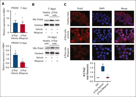 In β-thal erythroblasts, mitapivat normalizes the stress-induced upregulation and nuclear recruitment of Prx-2. (A) PRDX2 gene expression normalized on HBA1 expression in CD34+-derived erythroid precursors, on days 7 (upper) and 14 (lower) of culture, from patients with β-thal (cod β039) in vitro treated with vehicle or mitapivat (2 μM). Data are mean ± SEM (n = 5); ˆP < .05 (compared with vehicle-treated cells). (B) Western blot analysis of Prdx2 in erythroid precursors, as in panel A. Catalase served as loading controls. One representative immunoblot of other 4 with similar results. (C) Prdx2 immunostaining of CD34+-derived erythroid precursors from HC and patients with β-thal (cod β039) in vitro treated with vehicle or mitapivat (2 μM). DAPI (4′,6-diamidino-2-phenylindole) was used to stain nuclei. Prx2 mean fluorescence in the nucleus and cytoplasm was measured using ImageJ. Four different squares and at least 150 cells were analyzed. Data are presented as median and minimum/maximum, with boxes indicating 25th to 75th percentiles; ∗P < .05 (compared with HC); ˆP < .05 (compared with vehicle-treated cells).