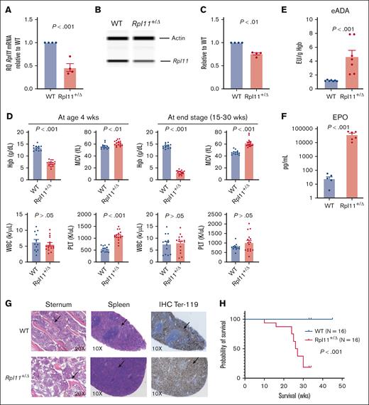 Rpl11-haploinsufficient mice recapitulate the hematologic phenotypes of patients with DBA. (A) Relative quantitative polymerase chain reaction showing Rpl11 messenger RNA levels in nucleated cells of the peripheral blood from Rpl11+/▵ mice and WT littermates. N = 4. (B-C) Representative western blot data show Rpl11 protein level in BM cells. N = 4. The area under the peak for Rpl11 and β-actin was calculated for the expression of Rpl11 protein relative to β-actin in BM-nucleated cells from Rpl11+/▵ mice and WT littermates. (D) Complete blood counts were performed using a HEMAVET 950FS analyzer. WT N = 13, Rpl11+/▵ N = 16. (E) Quantification of eADA in blood. The concentrations were normalized to blood Hgb levels. N = 7 per group. (F) Quantification of EPO concentrations in the plasma. N = 6 per group. (G) Representative morphology of the sternum and spleen. Hematoxylin and eosin–stained sections show that the sternum of Rpl11+/▵ mice were relatively hypocellular with substantially less trabecular bones compared with WT littermates, and their spleens lost the normal architecture without normal white pulp. Immunohistochemistry-stained sections show the abnormal distribution of Ter119+ cells in the spleens of diseased mice with Rpl11+/▵ (H) Kaplan-Meier analysis shows high penetrance (100%) of disease and a lethal impact of Rpl11- haploinsufficiency on survival of diseased mice with Rpl11+/▵ induced on postnatal day 8. The median survival age was 26.5 weeks in Rpl11+/▵ mice. N = 16 per group. Statistical differences between the groups were calculated using a 2-tailed Student t test. Data are presented as the mean ± standard error of the mean. More supportive data are provided in supplemental Figure 1. eADA, erythrocyte adenosine deaminase; MCV, mean corpuscular value; PLT, platelets; WBC, white blood cell counts; wks, weeks.