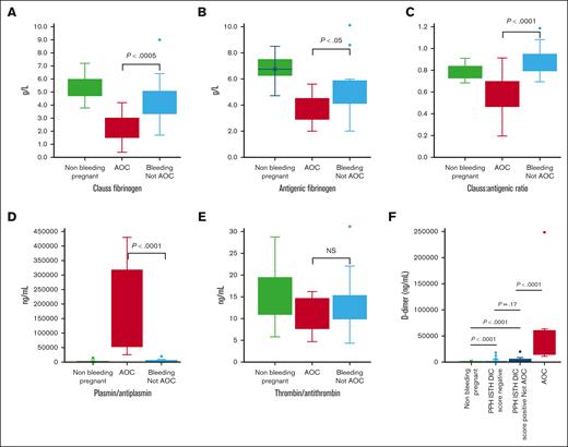 AOC is characterized by increased plasmin and loss of functional fibrinogen. Fibrinogen levels in the plasma samples from patients with AOC, patients with severe PPH without AOC, and nonbleeding pregnant controls were measured by (A) Clauss assay and as (B) total antigen, and (C) the ratio of Clauss:antigenic fibrinogen was then calculated. (D) PAP complexes and (E) thrombin/antithrombin complexes are illustrated. (F) D-dimer levels in cases of PPH with and without AOC grouped based on those that scored positive (score ≥ 26) or negative (score ≤25) on the ISTH criteria for obstetric DIC. Data are median (IQR). Analysis was by Kruskal-Wallis 1-way analysis of variance and Mann-Whitney U test with Bonferroni correction.