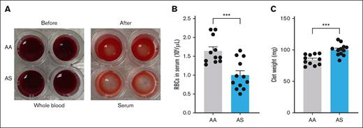 RBC extrusion during whole blood clot contraction. (A) Citrated whole blood was obtained from male or female AA (n = 11) and AS (n = 11) mice and was preincubated under hypoxic conditions (20 mm Hg for 4 hours) “before” the addition of tissue factor and calcium as described in “Methods.” The sample was incubated for a further 1 hour to allow clotting and retraction, “after” which RBCs extruded into the serum were enumerated. (B) Number of RBCs extruded into the serum during clot contraction. (C) Clot weights in AA and AS mice. ∗∗P < .01; ∗∗∗P < .001.