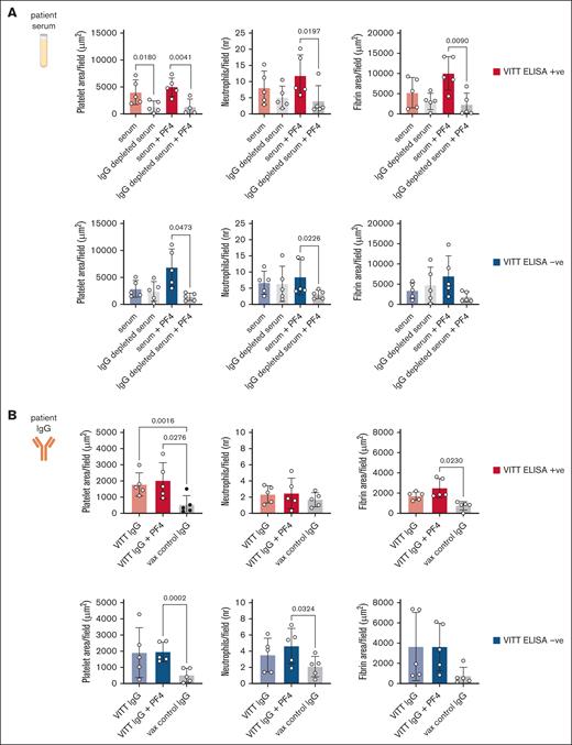 The endothelial thromboinflammatory response in VITT is antibody dependent. (A) Platelet fluorescence area per field, neutrophil count per field, and fibrin fluorescence area per field following a 15-minute blood perfusion in the Endo-chip after treatment with VITT ELISA positive serum or IgG depleted serum (upper panel) or with VITT ELISA negative serum or IgG depleted serum (lower panel) in the presence or absence of 25 μg/mL PF4. VITT ELISA positive n = 5 (patients 2, 3, 4, 6, 12), VITT ELISA negative n = 5 (patients 1, 3, 4, 5, 6). One-way ANOVA with Dunn post hoc test was used for comparisons. (B) Platelet fluorescence area per field, neutrophil count per field, and fibrin fluorescence area per field following a 15-minute blood perfusion in the Endo-chip after treatment with IgG isolated from the same VITT ELISA positive serum or VITT ELISA negative serum as in (A), in the presence or absence of 25 μg/mL PF4, in comparison with IgG isolated from vax control serum. VITT ELISA positive n = 5 (patients 2, 3, 4, 6, 12), VITT ELISA negative n = 5 (patients 1, 3, 4, 5, 6), vax controls n = 5. One-way ANOVA with Dunn post hoc test was used for comparison.