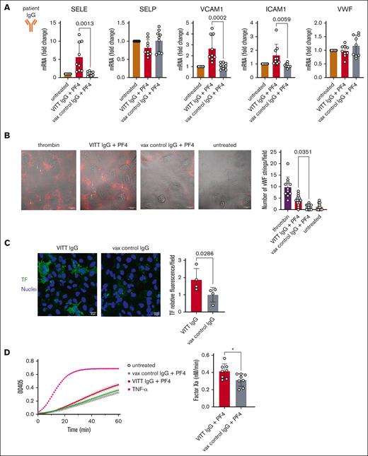 Treatment with VITT IgG and PF4 induces endothelial activation. (A) Relative mRNA expression of endothelial cells to glyceraldehyde-3-phosphate dehydrogenase in endothelial cells incubated with media (untreated), treated with VITT IgG and 25 μg/mL PF4, or with vax control IgG and 25 μg/mL PF4. Expression was determined for E-selectin (SELE), P-selectin (SELP), VCAM-1 (VCAM1), ICAM-1 (ICAM1), and VWF. There were n = 3 repeats of n = 3 VITT ELISA positive IgG (patients 3, 4, 11) and n = 3 vax control IgG (patients 1, 2, 5). One-way ANOVA with Dunn post hoc analysis was used for comparisons. (B) Left: release of VWF after stimulation of endothelial cells with thrombin, VITT IgG and 25 μg/mL PF4, vax control IgG and 25 μg/mL PF4, or untreated. Representative images. Right: quantification of the average number of VWF strings per field after stimulation with thrombin, VITT IgG + PF4, vax control IgG + PF4, and untreated. A total of 2 to 3 fields of view were used for n = 3 VITT ELISA positive IgG (patients 3, 4, 11) and n = 3 vax control IgG (patients 1, 2, 5). One-way ANOVA with Tukey post hoc test was used for comparisons. (C) Left: representative immunofluorescent images of TF staining (green) of HUVECs after incubation with IgG isolated from VITT or vax control serum. Nuclei are stained with Hoechst (blue). Right: TF fluorescence intensity units after incubation of HUVECs with VITT IgG or vax control IgG; average of n = 3 fields of view from 4 VITT ELISA positive (patients 2, 4, 6, 13) and 3 vax controls (patients 1, 2, 5). Unpaired t tests were used for comparisons. (D) Left: kinetic curve of Xa generation after treatment of endothelial cells with media (untreated), VITT IgG + 25 μg/mL PF4, vax control IgG + 25 μg/mL PF4, and 10 ng/mL TNF-α (left panel). Right: factor Xa generation after treatment of endothelial cells with VITT IgG + PF4 vs vax control IgG + PF4. There were 3 repeats for 3 VITT ELISA positive IgG samples (patients 4, 6, 13) and 3 vax control IgG samples (patients 1, 2, 5). Unpaired t tests were used for comparison.