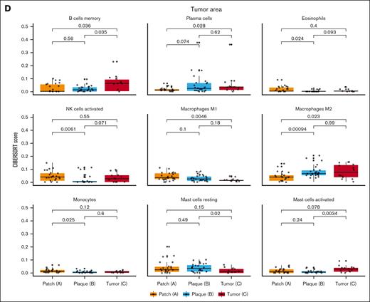 Immune cell profiling of patch-, plaque-, and tumor-stage MF. UMAP (A) and correlation plot (B) revealed that the immune cell composition of tumor-stage MF was distinct from patch- or plaque-stage MF. (C) Pairwise box plots of immune cell scores (memory B cells, plasma cells, follicular helper T cells, activated NK cells, M0 macrophages, M2 macrophages, activated dendritic cells, resting mast cells, and activated mast cells) determined by CIBERSORTx in 32 immune cell areas. (D) Pairwise box plots of immune cell scores (memory B cells, plasma cells, eosinophils, activated NK cells, M1 macrophages, M2 macrophages, monocytes, resting mast cells, and activated mast cells) analyzed with CIBERSORTx in lymphoma cell areas.