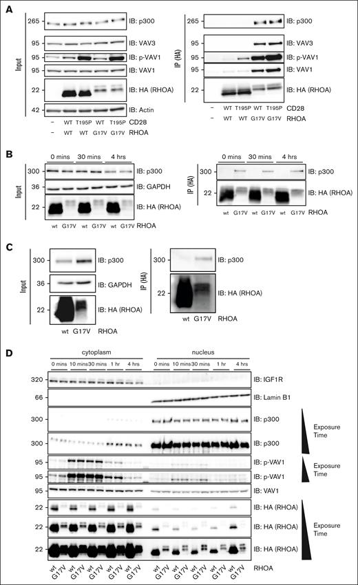RHOA G17V interacts with p300 and both colocalize. (A) RHOA G17V interacts with p300 in modified Jurkat cells. Representative western blot analysis of lysates (left) and anti-HA IP of ectopically expressed HA-tagged RHOA (right) for the indicated cell lines. Cells were costimulated with anti-CD3, anti-CD28, and crosslinker at 2 μg/mL for 5 minutes. Whole-cell lysates (input, left) and (IP, right) were analyzed by immunoblotting (IB) using anti-HA, anti–p-VAV1, anti-VAV1, anti-VAVA3, and anti-p300 antibodies. Positions of molecular weight markers are indicated in kilodalton. The experiment was performed 3 times. (B) RHOA G17V interacts with p300 at every time point of costimulation. Representative western blot analysis of lysates (left) and anti-HA IPs of ectopically expressed HA-tagged RHOA (right) from the indicated cell lines. Cells were costimulated with anti-CD3, anti-CD28, and crosslinker at 2 μg/mL during the indicated periods of time. Whole-cell lysates (input, left) and IPs (right) were analyzed by IB using anti-HA, anti-GAPDH, and anti-p300 antibodies. The experiment was performed 3 times. (C) RHOA G17V interacts with p300 in human primary T cells. Representative western blot analysis of lysates (left) and anti-HA IPs of ectopically expressed HA-tagged RHOA wt or G17V (right) from human primary T cells. Whole-cell lysates (input, left) and IPs (right) were analyzed by IB using anti-HA, anti-APDH, and anti-p300 antibodies. Positions of molecular weight markers are indicated in kilodalton. The experiment was performed twice. (D) Representative western blot analysis of cytoplasmic (left) and nuclear (right) cellular fractions of cell lines expressing ectopically either the wt or G17V form of RHOA. Cells were costimulated with anti-CD3, anti-CD28, and crosslinker at 2 μg/mL during the indicated time periods. Whole-cell lysates were analyzed by IB using the indicated antibodies. IGF1R and Lamin B1 immunoblots show the separation between cytoplasmic and nuclear fractions. The experiment was performed twice. GAPDH, glyceraldehyde-3-phosphate dehydrogenase.