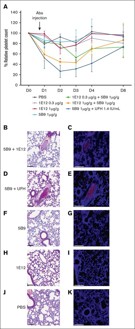 5B9 and 1E12 induce thrombocytopenia and thrombosis in vivo. (A) Evolution of platelet count (PC) after injection of 5B9 (1 μg/g body weight; n = 4), 1E12 (0.3 or 1 μg/g; n = 3) or both Abs (n = 3) in transgenic HIT mice (human FcγRIIA, human G6b-B, human PF4 transgenic, mouse PF4 knockout). At days 1, 2, 3 and 4, 1.4 IU/g of UFH was injected in mice treated with 5B9 (n = 3). Data are represented as mean ± SEM. Mann-Whitney U test was performed to compare the different conditions tested. ∗P < .05. (B-E) Sections of lungs with intravascular thrombi from mice injected with 1E12 1 μg/mL + 5B9 1 μg/mL (B-C) or 5B9 1 μg/mL + UFH 0.1 IU/mL (D-E). (F-K) Sections of lungs without thrombi (controls) in mice injected with 5B9 1 μg/mL (F-G), 1E12 1 μg/mL (H-I), or PBS (J-K). Sections were stained using hematoxylin, phloxine, and saffron (HPS) in panels B,D,F,H,J or immunofluorescence in panels C,E,G,I,K. Scale bar, 100 μm (for HPS staining and 150 μm for immunofluorescence).