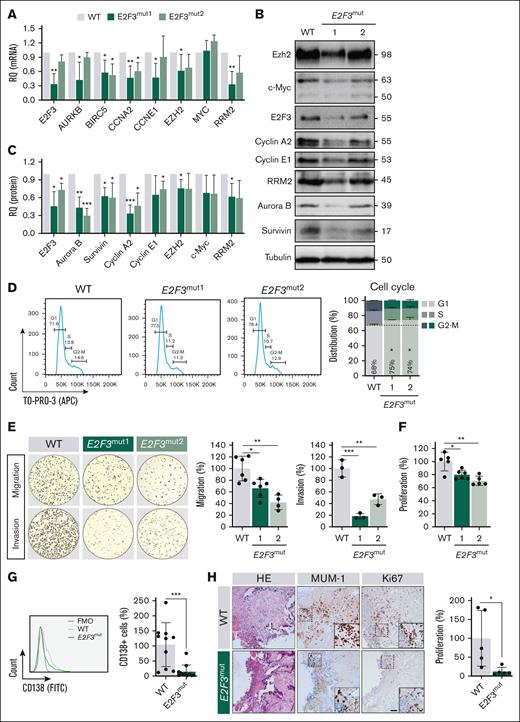 E2F3 contributes to lymphomagenesis of PBL. (A) Relative mRNA expression of E2F3 and target genes involved in cell cycle, in PBL-1 E2F3mut1 and E2F3mut2 (green) normalized to WT cells (gray). (B) Representative western blot images of E2F3 and its targets involved in cell cycle, in PBL-1 WT, E2F3mut1, and E2F3mut2 cells. (C) The relative protein expression normalized to PBL-1 cells. (D) Cell cycle was assessed by flow cytometry through TO-PRO-3 (APC) staining (left), and the percentage of cells in each cell cycle phases are shown in PBL-1 WT, E2F3mut1, and E2F3mut2 cells (right). (E) Migration and invasion of WT, E2F3mut1, and E2F3mut2 cells were determined at 48 hours in 5-μm-pore membranes of transwell inserts. The cells that migrated and invaded the lower chamber were fixed, stained with Giemsa, and counted (left). Relative migration and invasion plots (%) are shown (right). (F) Cell proliferation was determined by 3-(4,5-dimethylthiazol-2-yl)-2,5-diphenyltetrazolium bromide assay and relative proliferation of E2F3 mutant cells normalized to WT ones is shown. (G) PBL-1 cells were inoculated in the chicken CAM in vivo model. The number of tumoral cells in the tumors developed after 7 days after cell inoculation was assessed by CD138-FITC staining. Flow cytometry plot of cells expressing CD138 (left) and the relative CD138+ cells in E2F3mut tumors normalized to WT ones (right). (H) Representative images of hematoxilin-eosin (HE), MUM-1, and Ki67 immunohistochemistry staining from formalin-fixed, paraffin-embedded sections of CAM samples (left); and relative proliferation of WT and E2F3mut tumors (right). All in vitro experiments were performed in biological triplicates and technical duplicates unless otherwise specified; in vivo CAM experiments were performed in 5 to 10 eggs. Statistical significance was determined by t test or analysis of variance (ANOVA) test or t test. ∗P < .05; ∗∗P < .01; ∗∗∗P < .001. FITC, fluorescein; HE, hematoxylin and eosin.