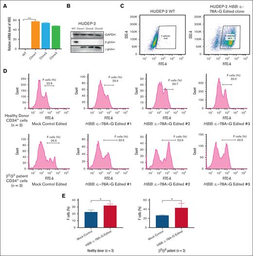 The HBB:c-78A>G mutation leads to reactivation of γ-globin in HUDEP-2 cells and CD34+ cells. (A) Quantitative measurement of HBG mRNA expression with the HUDEP-2 cells and HBB:c.-78A>G single clone by qPCR. (B) WB in HUDEP-2 WT cells with the HBB:c.-78A>G single clone. (C) Hb F production by flow cytometry from HUDEP-2 WT cells and HBB:c.-78A>G single clone. (D) Hb F–positive cells analyzed by flow cytometry are represented as upper histograms referring to edited 3 healthy donors CD34+ cells. The lower histograms refer to edited 3 patients with β0/β0 CD34+ cells on day 16 of differentiation (n = 3). (E) Flow cytometry analysis of Hb F–positive cells in erythroblasts derived from edited 3 healthy donors and 3 patients with β-thalassemia CD34+ cells on day 16 of differentiation (n = 3). Asterisks indicate levels of statistical significance. ∗P < .05. FITC-A, fluorescein isothiocyanate-area; GAPDH, glyceraldehyde-3-phosphate dehydrogenase; mRNA, messenger RNA; SSC-A, side scatter-area.