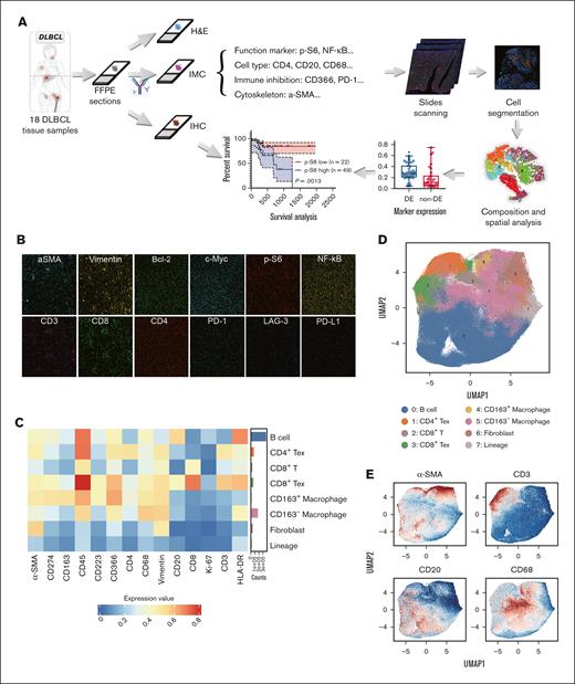 IMC pipeline based on the 26-marker panel. (A) The workflow of IMC. Continuous tissue sections of 18 patients with DLBCL were analyzed by IMC, H&E stain, and IHC. Protein expression of functional markers analyzed by IHC was to confirm the results from IMC. Patient prognosis based on differential expression of functional markers was retrospectively studied later in this study. (B) Representative IMC images showed the distribution of various markers. Scale bar, 200 μm. (C) Heat map of cellular phenotypes. A heat map represents major cell types identified within the TME. (D) UMAP plots were based on the single-cell data extracted from IMC images; 8 clusters from samples collected from 18 patients with DLBCL were defined according to their marker expression. (E) Representative images showed the distribution of cell type markers in UMAP plots. UMAP, uniform manifold approximation and projection.