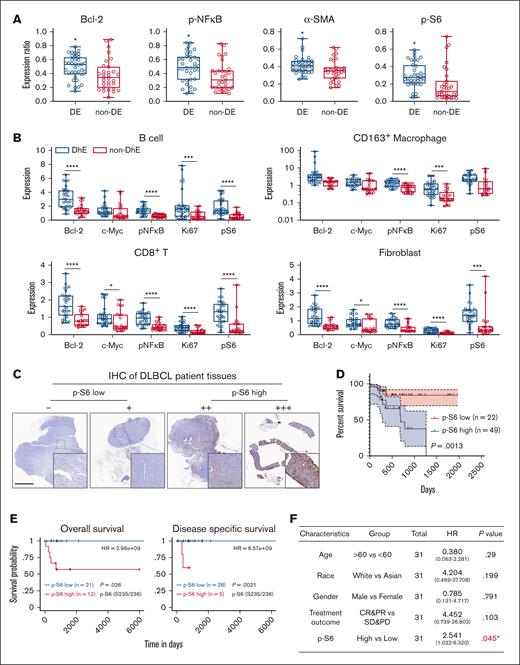 Differential protein expression in DE and non-DE DLBCL samples. (A) Bar plots showing the statistical analysis of indicated protein expression in DE and non-DE DLBCL samples. (B) The differential expression of indicated functional markers in various cell types between DE and non-DE DLBCL samples. (C) IHC was performed to validate the expression of p-S6 in 18 DLBCL specimens, and 4 representative images of p-S6 staining were shown to validate IHC staining scores. (D) Survival analysis of 71 patients with DLBCL in our respective study was performed using GraphPad Prism software (version 8). (E) Overall survival (OS) and disease-specific survival analysis of p-S6 (235/236). Protein arrays data were performed on TRGAted (https://nborcherding.shinyapps.io/TRGAted/). Grouping by “auto select best cutoff.” (F) Univariate analysis of The Cancer Genome Atlas database. HR >1 is poorly prognostic; HR <1 indicated improved OS and any characteristic crossing the line at 1 is not significant. CR, complete response; HR, hazard ratio; PD, progressive disease; PR, partial response; SD, stable disease. ∗p < .05; ∗∗∗p < .001; ∗∗∗∗p < .0001.