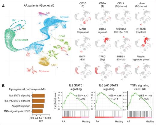 Immune activation pathways are upregulated in the MKs from patients with AA demonstrated by scRNA-seq. (A) A UMAP plot of single BM cell gene expression of patients with AA (n = 9) and healthy controls (n = 4). Cells are colored by types (erythroblast, MK, myeloid, NK, CD8+ T cell, CD4+ T cell, and B/plasma cells). Expression of cell-type signature genes are highlighted in UMAP plots. (B) GSEA of expressed genes in MKs from patients with AA compared with those in healthy donors. Normalized enrichment scores (NES) for the GSEA pathways are plotted, showing higher enrichment of the inflammatory pathways in MKs from patients with AA. IL2/6, interleukin-2/6.