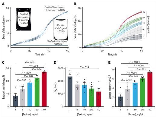 Kinetic curves and parameters characterizing the shrinkage of thrombin-induced clots made from purified fibrinogen mixed with washed RBCs in the absence and presence of various concentrations of 100 kDa dextran. (А) Comparative kinetic curves and representative photographic images showing a shrunken clot from purified fibrin(ogen) mixed with 100 kDa dextran and RBCs (left) vs an unshrunken clot from purified fibrin(ogen) mixed with RBCs only. (B) Kinetic curves of RBC-induced clot shrinkage (extent of clot shrinkage over time) at various dextran concentrations. (C) The extent of clot shrinkage after 1 hour. (D) Lag time of clot shrinkage after addition of thrombin. (E) Average shrinkage rate. The results from 5 duplicated independent experiments are presented as the mean ± standard error of the mean and analyzed with the ordinary 1-way analysis of variance test with Tukey multiple comparisons post hoc test.