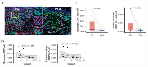 ROCK2 inhibition with belumosudil reduces collagen, T cells, and IL-17–producing cells in the oral buccal mucosa. (A) Representative PSR (picrosirius red) staining paired with polarized microscopy of OM sections before and after treatment with belumosudil showing changes in collagen type I (red) and collagen type III (green). White dashed line denotes epithelial-submucosal border. (B) Changes in percentage area of collagen types I and III in the OM (n = 16; paired parametric t test). (C) Representative multiplex immunofluorescence staining for DAPI (blue), CD3 (cyan), CD4 (red), and IL-17 (green) in the OM before and after treatment with belumosudil with close-up view of marked region in yellow. (D) Changes in CD3+ T, CD4+, IL-17+, CD3+CD4+ T, CD3+CD4− (CD8) T, Th17, CD3−CD4+, and CD3− IL-17+ cells after belumosudil treatment (n = 14; Wilcoxon signed-rank test). (E) Representative multiplex immunofluorescence staining for DAPI (blue), Vim (green), CD68 (red), α-SMA (magenta) in the OM before and after treatment with belumosudil with close-up view of marked region in yellow. (F) Changes in macrophages (CD68+) and activated macrophages (CD68+Vim+ cells) after belumosudil treatment (n = 8; Wilcoxon signed-rank test). (G) Scatterplots showing negative correlation between macrophages and activated macrophages with collagen I. P value <.05 is considered significant. Scale bar of 100 μm was used. α-SMA, α-smooth muscle actin; DAPI, 4′,6-diamidino-2-phenylindole; Vim, vimentin.