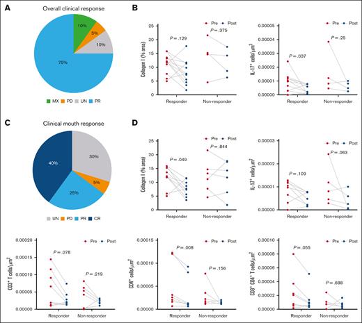 Clinical responders to belumosudil had reductions in OM IL-17 cells, immune cells, and local type I collagen that were not observed in nonresponders. (A) Pie chart showing the percentage of total patients (n = 20) with overall clinical response of MX, PD, UN, or PR. (B) Overall clinical response classification of changes in OM collagen type I and IL-17+ cells between responders and nonresponders with belumosudil (n = 16). Responders included PR, and nonresponders included MX, PD, and UN. (C) Pie chart showing percentage of total patients (n = 20) with clinical mouth response of UN, PD, PR, and CR. (D) Clinical mouth response classification of differences in percentage area of collagen type I, IL-17+, CD3+ T, CD4+, and CD3+CD4+ T cells before and after treatment in the cohort (n = 16) of responders and non-responders in the OM. Responders included PR and CR, and nonresponders included UN and PD. P value <.05 is considered significant. Wilcoxon signed-rank test was performed. MX, mixed response.