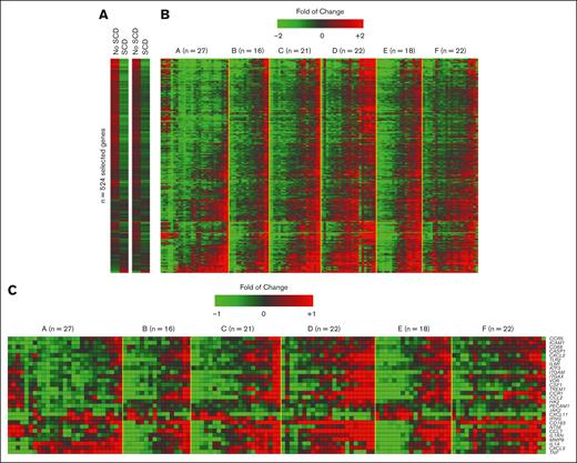 Expression levels of transcripts identified through WGCNA. (A) Mean expression levels of 524 transcripts. Mean expression of all 524 genes for individuals with and without SCD from the single-center cohort (2 columns on left) and multicenter cohort (2 columns on right), each row represents a gene. (B) Individual expression levels of transcripts grouped by center. Variation in gene expression between individuals with SCD, separated by different centers (unique centers labeled A through F, total number of individuals in each center indicated in parentheses). The columns within each center group represent an individual from the respective center (labeled as A through F), each row represents a gene. (C) Annotated heat map of expression levels of pain-related genes. Variation in gene expression displayed of genes significantly associated with clinical pain data in the study cohort and that have been shown to be related to pain in the published literature. Each row represents a gene. The columns within each group (separated by centers A through F) represent an individual from the respective center. Most of the genes (60%) are from the blue module. Note: the individuals in panels B-C are ordered by hierarchical clustering that is done center by center using Genesis. For each center, hierarchical clustering was done based on gene expression level.