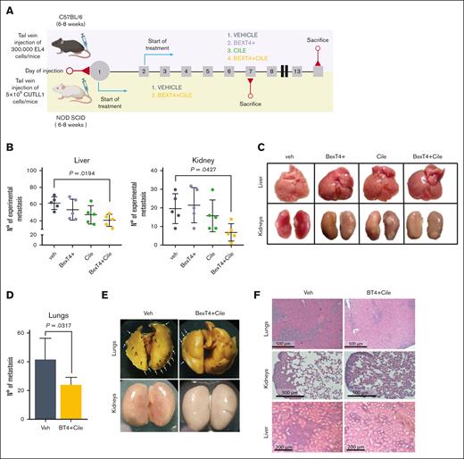 Bex and Cile combinatorial effect on TCL dissemination. (A) Graphical representation of the in vivo metastatic models and treatment schedule including Veh, bexarotene with levothyroxine replacement (BexT4+), Cile alone, or Bex with levothyroxine and Cile (BexT4+Cile). (B) Quantification of the number of experimental metastases in the liver and kidneys in the different groups in EL4 in vivo model. (C) Representative photographs of the livers and kidneys from the mice of the different treatments. (D) Quantification of the number of experimental metastases in the lungs of the different groups of treatment in the CUTLL1 in vivo model. (E) Representative photographs of lungs and kidneys from NOD-SCID (arrows point to CUTLL1 micronodules). (F) Representative photographs of hematoxylin and eosin–stained lung, kidney, and liver tissues (n = 5 per group).