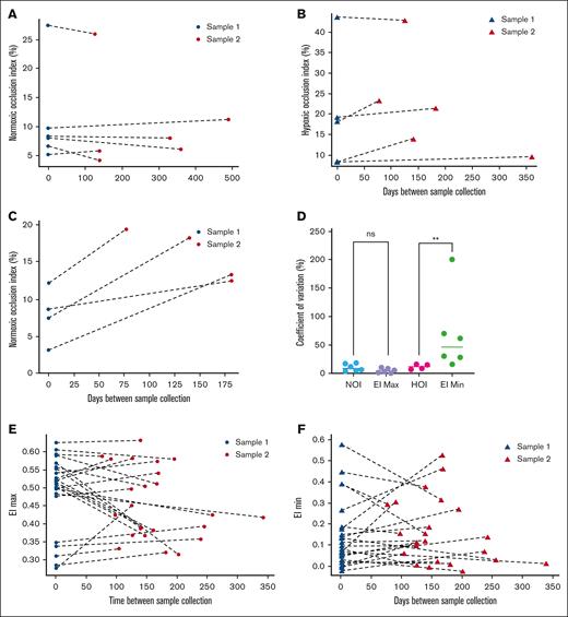MIRCA is a reproducible assay. (A-C) MIRCA OIs for individuals with HbSS were recorded longitudinally at routine clinic visits between November 2022 and July 2024. The NOI (n = 6) (A) and HOI (n = 5) (B) of steady-state individuals remained stable over time (P = .44, P = .13, Wilcoxon signed rank test) with a median percent point change of 13.3% and 15.7%, respectively. Four individuals (C) were not at steady state, defined as having had an acute VOE or ACS episode within the past 30 days, and were analyzed separately. The median NOI value of individuals with recent history of acute crisis rose by 101% compared with initial baseline measurement and median NOI increased by 8.6% (P = .12, Wilcoxon signed rank test). (D) CVs from comparable biomarkers (NOI vs EI Max and HOI vs EI Min) were compared using a nonparametric Mann-Whitney U test. Although NOI and EI Max were not significantly different in terms of reproducibility (P = .13), EI Min was found to have a 33.9% higher CV compared with HOI (P = .0095). Raw values used to calculate CVs can be found in supplemental Table 1. LoRRca EI Max (E) and EI Min (F) values in another 25 HbSS steady-state individuals were also recorded longitudinally at routine clinic visits, with median percent point changes of 15.7% and 82.1%, respectively. However, the intrapatient difference between MIRCA and LoRRca biomarker values between sample collection time was not significantly different from 0 using a 1-sample t test: NOI (P = .32), HOI (P = .09), EI Max (P = .15), and EI Min (P = .61). ∗∗P ≤ .01. ns, not significant.