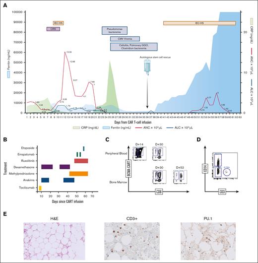 Clinical, biochemical and correlative analysis for patient 1. (A) Time course of events following CAR T-cell infusion, including adverse events, infectious complications, stem cell infusion, and trends of inflammatory markers and blood counts. (B) Therapeutic strategies employed for managing CAR T-cell–related toxicities. For the first episode of CRS and IEC-HS, the patient received tocilizumab 8 mg/kg for 2 days, 10 mg every 6 hours of dexamethasone tapered over 10 days (tapered), and anakinra 100 mg every 6 hours tapered over 7 days. In the second episode of IEC-HS, the patient received 1 g of methylprednisolone for 3 days with a prolonged taper, along with a dexamethasone taper. Anakinra was started at 100 mg every 6 hours and tapered to every 24 hours over 1 week. Ruxolitinib was initiated at 5 mg daily and increased to twice daily, and was stopped after a week because of concerns about gastrointestinal bleeding. Two doses of emapalumab (1 mg/kg) were administered after high doses of steroids and anakinra failed to improve the clinical course. Finally, the patient received etoposide 50 mg/m2 3 days before death. (C) Immunophenotyping of BM and peripheral blood, showing CAR T-cell expansion, gated on CD3+ viable lymphocytes. (D) Immunophenotyping on day 62 (1 day before the patient died), demonstrating the expansion of mononuclear type cells. (E) H&E staining of BM on day 30 after CAR T-cell therapy but before stem cell boost, showing marked paucicellularity (<5%) (left) and immunohistochemistry demonstrating scattered CD3+ T cells (middle), and PU.1+ cells, which are overexpressed in monocytes, dendritic cells, and histiocytes (right). ALC, absolute lymphocyte count; ANC, absolute neutrophil count; CMV, cytomegalovirus; CRP, C-reactive protein; GGO, ground glass opacity; H&E, hematoxylin and eosin.