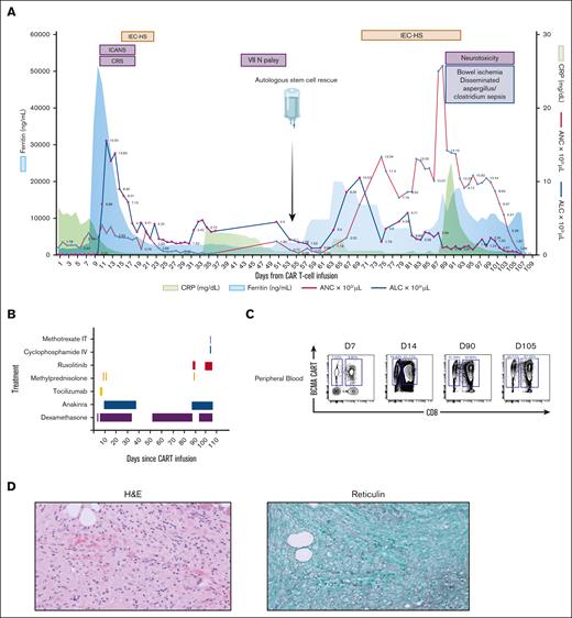 Clinical, biochemical and correlative analysis for patient 2. (A) Time course of events following CAR T-cell infusion, including adverse events, infectious complications, stem cell infusion, and trends of inflammatory markers and blood counts. (B) Therapeutic strategies employed for managing CAR T-cell–related toxicities. For the first episode of CRS, immune effector cell–associated neurotoxicity syndrome (ICANS), and IEC-HS, the patient received 2 doses of tocilizumab (8 mg/kg), followed by methylprednisolone (1 g), and a dexamethasone taper for ICANS, along with anakinra (100 mg every 6 hours) for 5 days, which was then tapered over 10 days. For recurrent IEC-HS, treatment was initially started with dexamethasone (10 mg every 6 hours) but was later escalated to methylprednisolone (1 g) because of a refractory clinical course. Anakinra (100 mg every 6 hours) and ruxolitinib (5 mg twice daily) were also added. In addition, the patient received intrathecal methotrexate (12 mg) and IV cyclophosphamide (500 mg/m2) 2 weeks before death. (C) Immunophenotyping of peripheral blood, showing CAR T-cell expansion, gated on CD3+ viable lymphocytes. (D) H&E staining of BM on day 28 (after cilta-cel infusion) (left), demonstrating hypocellular marrow (<10%) with extensive marrow fibrosis in trichrome staining (right). ALC, absolute lymphocyte count; ANC, absolute neutrophil count; CRP, C-reactive protein; VII N palsy, seventh cranial nerve palsy.