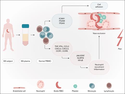 Plasma-induced signatures of pain in SCD. Plasma from individuals with SCD was cocultured with PBMCs from a single healthy donor. Transcriptomic analysis of PBMCs showed increased transcripts of 10 genes involved in cell adhesion, neutrophil recruitment, and inflammation, among others leading to vaso-occlusion and pain. Professional illustration by Somersault18:24. IFN-γ, interferon gamma; ITGAM, integrin subunit alpha M; ITGAX, integrin subunit alpha X; NF-κB, nuclear factor κB; NLRP3I, NLR family pyrin domain containing 3 inflammasome; RBC, red blood cell; SS, homozygous SCD; TNF, tumor necrosis factor.