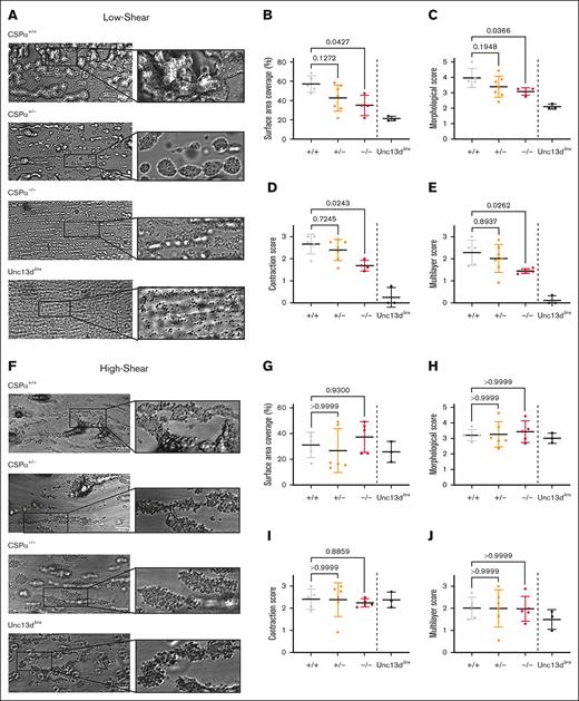 CSPα−/− mice have defective thrombosis under flow at low shear rates. A BioFlux microfluidics system was used to examine thrombus formation at a low shear rate of 10 dyn/cm2 (A-E) or high shear rate of 35 dyn/cm2 (F-J) over immobilized collagen for CSPα+/+, CSPα+/−, and CSPα−/− mice. Historic data from the laboratory for Unc13dJinx mice was added for reference. (A) Representative images of thrombus formation were taken for CSPα+/+ (n = 5), CSPα+/− (n = 7), and CSPα−/− (n = 4) mice at low shear rates during postperfusion washing. Quantitative analysis of platelet surface area coverage (B), morphological score (C), contraction score (D), and multilayer score (E) were measured at a low shear rate. (F) Representative images of thrombus formation were taken for CSPα+/+ (n = 5), CSPα+/− (n = 6), and CSPα−/− (n = 5) mice at high shear rates during postperfusion washing. Quantitative analysis of platelet surface area coverage (G), morphological score (H), contraction score (I), and multilayer score (J) were measured at the high shear rate. Scaled from 0 (no thrombus formation) to 5 (fully formed contracted and multilayered thrombi) for morphological score. Contraction and multilayer scores were scaled from 0 (no thrombus formation) to 3 (fully formed contracted and multilayered thrombi). Statistical analyses were performed using individual values and the Kruskal-Wallis multiple comparison test and corrected using the Dunn multiple comparison test. The P values are indicated. Scale bar, 50 μm.