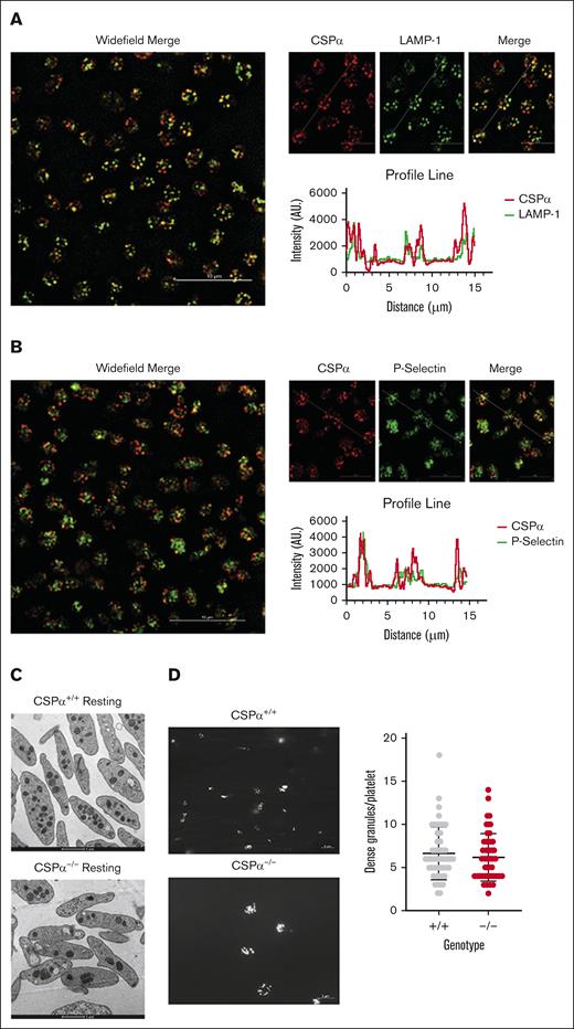 CSPα is membrane-associated and present on both lysosomes and α-granules. (A) WT platelets were immunostained for CSPα (red) and LAMP-1 (green), and imaged using 3-dimensional structured illumination microscopy (3D-SIM). The white lines in the merged images indicate where the profile line analyses were performed. Profile line analyses are shown below the images. (B) WT platelets were immunostained for CSPα (red) and P-selectin (green), and imaged using 3D-SIM. Scale bar, 10 μm for widefield images; 5 μm for cropped images. (C) Resting platelets from CSPα+/+ and CSPα−/− mice were isolated and fixed in their resting state. Transmission electron microscopy micrographs were analyzed for platelet shape and granule distribution. Scale bar, 1 μm. (D) Resting platelets from CSPα+/+ and CSPα−/− mice were isolated, labeled with 1 μM mepacrine for 30 minutes, and imaged by epifluorescence microscopy to count dense-granule numbers. Scale bar, 5 μm. The number of mepacrine-positive granules was counted and graphed (Mann-Whitney U test, P = .4617). AU, arbitrary units.