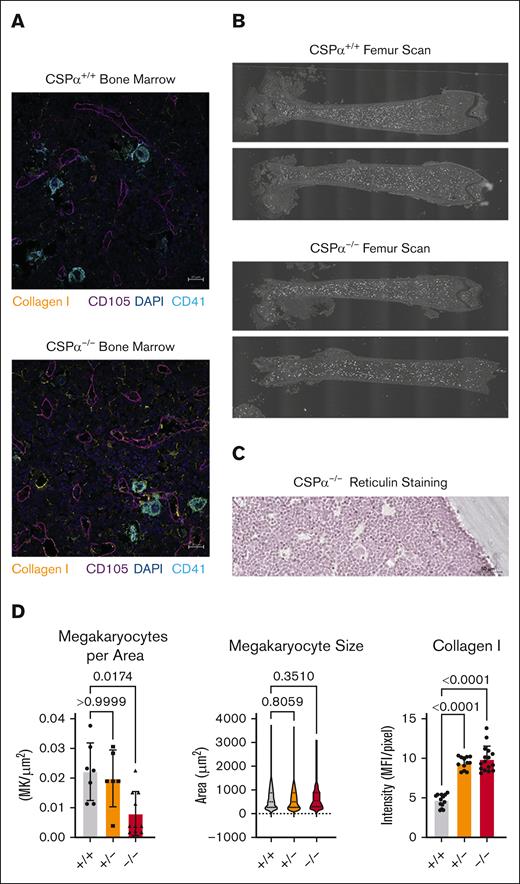 CSPα−/− mice have reduced bone marrow megakaryocyte numbers and increased collagen I deposition. (A) Representative images of femur bone marrow from CSPα+/+ and CSPα−/− mice (aged 5-6 weeks). Collagen I (yellow), CD105 (purple), DAPI (blue), and CD41 (cyan). Scale bar, 20 μm. (B) Representative scan images of the femur from CSPα+/+ and CSPα−/− mice stained for CD41 (megakaryocyte). (C) Reticulin staining of marrow from CSPα−/− mice. Scale bar, 50 μm. Supplemental Figure 8 for WT marrow and fibrotic liver controls. (D) Quantification of megakaryocytes per area, megakaryocyte size, and collagen I intensity in the femurs of CSPα+/+, CSPα+/−, and CSPα−/− mice. Bones from CSPα+/+ (n = 4; male = 3, and female = 1), CSPα+/− (n = 3; male = 2, and female = 1), and CSPα−/− (n = 4; male = 2, and female = 2) mice were evaluated. Megakaryocytes per area and megakaryocyte size were evaluated by examining the number and size of CD41+ cells. Quantification of collagen I fluorescence intensity was measured within each image. Statistical analyses were performed using individual values and the Kruskal-Wallis multiple comparison test and corrected using the Dunn multiple comparison test. The P values are indicated. Scale bar, 20 μm.