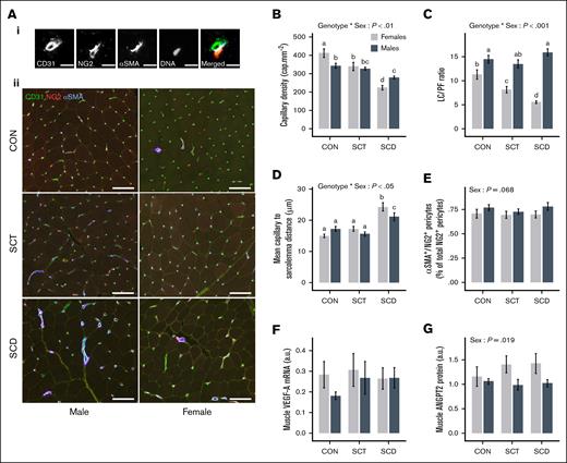 Analysis of skeletal muscle microvasculature indices and determinants among sex for CONs, carriers of SCT, and patients with SCD. (Ai) Representative micrograph of skeletal muscle cryosections stained for CD31 (endothelial cells), NG2, and αSMA (both for pericytes). Focus on a single skeletal muscle capillary with split channels. Scalebar: 10 μm. (Aii) Large view of muscle cryosections for each condition. Scale bar, 100 μm. (B-G). Comparison of skeletal muscle microvasculature indexes and determinants between genotype and sex (white bar, females; gray bar, males). The effects of genotype ∗ sex and sex were obtained with 2-way ANOVA analysis. Post hoc analysis: a,b,c,dconditions not sharing the same letter were significantly different (P < .05). NG2, neural-glial antigen 2.