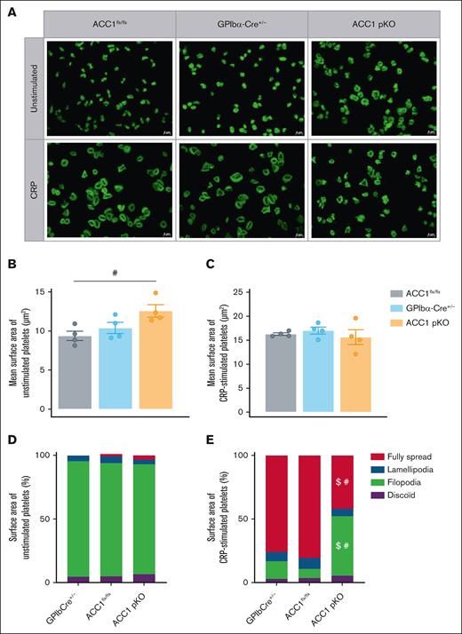 Platelet-specific ACC1 deletion affects platelet spreading and actin cytoskeleton organization upon CRP stimulation. (A-E) Washed murine platelets were stimulated with or without CRP 0.3 μg/mL for 30 minutes. Platelets were stained with phalloidin-fluorescein isothiocyanate for 45 minutes at room temperature. (A) Panel of representative pictures. Scale bar, 5 μm. (B-C) Quantification of the mean surface area covered by (B) unstimulated or (C) CRP-stimulated platelets independently of the platelet morphology. Data are expressed as mean ± SEM (n = 4). #P ≤ .05 relative to ACC1flx/flx mice. Data underwent 1-way ANOVA. (D-E) Proportion of the surface area covered by (D) unstimulated or (E) CRP-stimulated platelets, being inactivated (discoid), extending filopodia, forming lamellipodia or fully spread after activation. Data are expressed as means ± SEM (n = 4). #P ≤ .05 relative to ACC1flx/flx mice. $P ≤ .05 relative to GPIb-Cre+/− mice. Data underwent 2-way ANOVA.