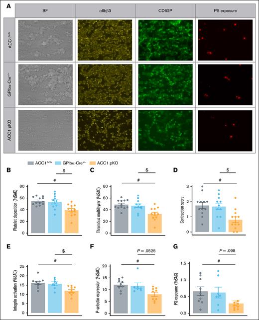 ACC1 deficiency in platelets impaired their activation and thrombus formation under flow conditions. (A-G) Whole blood from ACC1flx/flx, GPIbα-Cre+/−, and ACC1 pKO mice was perfused over collagen 1–coated surface (50 μg/mL) at a shear rate of 1000/s. (A) Representative images of multilayered platelet thrombi, and activated αIIbβ3, CD62P, and phosphatidylserine (PS) stainings. (B-D) Platelet deposition, thrombus formation and contraction score were assessed on BF images. (E) αIIbβ3 activation was evaluated using JON/A Ab, (F) P-selectin exposure was evaluated via staining with anti-CD62P antibody, and (G) PS exposure was determined using annexin V. The results are expressed as mean ± SEM (≥4 mice per group). #P ≤ .05 relative to ACC1flx/flx mice. $P ≤ .05 relative to GPIbα-Cre+/− mice. One-way ANOVA was used for analysis. BF, brightfield; JON/A Ab, JON/A antibody; SAC, surface area covered.