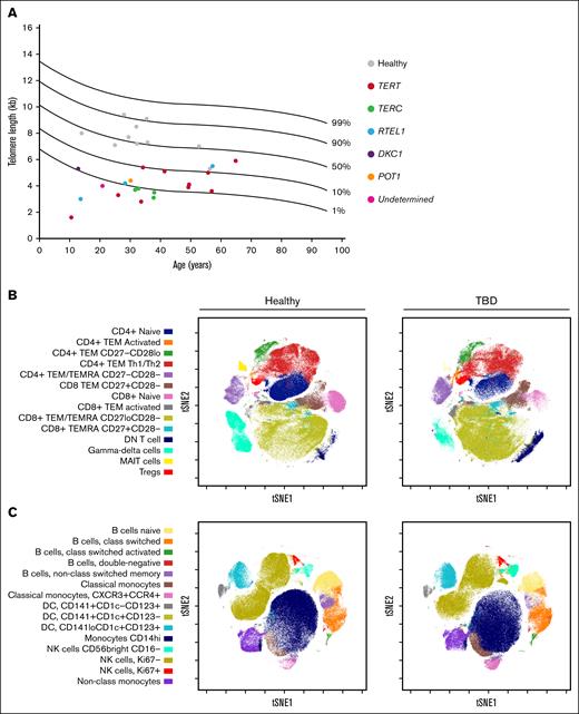 TL in PBMCs and clusters identified by Flow-SOM in CD3+ and CD3– populations. TL was measured in PBMCs by southern blot of TRFs, and germ line variants were identified by next-generation sequencing or Sanger sequencing. Stained PBMCs were gated for CD3+ and CD3–, then automatically clustered by Flow-SOM algorithm. The resulting populations were visualized by viSNE maps. (A) TL (kilobase) for each subject included in the study, according to age and, in case of patients, affected genes. (B-C) Fourteen subsets identified in CD3+, and 15 subsets identified in CD3– cells, respectively, in healthy controls and patients with TBD (155 000 events each). DC, dendritic cell; DN, double-negative; NK, natural killer; TEM, T effector memory; TEMRA, T effector memory CD45RA+; Th, T helper; tSNE1, t-distributed stochastic neighbor embedding.