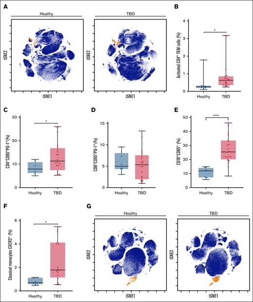 TBDs are associated with a higher prevalence of activated and exhausted cells. Several activation and exhaustion markers were identified in a T-cell subpopulation enriched in patients with TBD; additionally, Fas receptor (CD95) and PD-1 overexpression could explain the decline of CD4+ T and B cells in that group. (A) viSNE map showing a population of CD4+ effector cells being enriched in patients. (B) Percentages of the subset defined in panel A. (C-D) Expression of CD95 and PD-1 in CD4+ and CD8+ cells, respectively. (E) Expression of CD95 in B cells. (F) Percentage of infiltrating monocytes expressing CXCR3 identified in CD3– cells. (G) Infiltrating CXCR3+ monocytes highlighted on viSNE maps, with expansion in patients with TBD. ∗P ≤ .05; ∗∗∗∗P ≤ .0001.TBD, telomere biology disorder; TEM, T effector memory; t-SNE, t-distributed stochastic neighbor embedding.