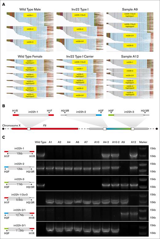 Analysis of int22h-related rearrangements. (A) Results of DAHH. Three sets of haplotypes were assembled in wild-type males, and 5 sets of haplotypes were assembled in wild-type females. The fusion fragments int22h-1/2or3 and int22h-3/1 were identified in samples with Inv22 type I (use A1 as an example for the male Inv22 type I, and A4-2 as an example for the female Inv22 type I carrier.) A9 and A12 are considered int22h-related complex variants. (B) LR-PCR for int22h-related rearrangements. The locations of the 5 primers (H1F, H2F, H3F, H1R, and H2/3R) in the reference genome. (C) Results of LR-PCR. Five primers were used in different combinations to amplify int22h-1, int22h-2, int22h-3, and the fusion fragments int22h-1/2or3, int22h-2/1, and int22h-3/1. Samples A1, A2, A4, A6, A7, and A10 were identified as Inv22 type I; samples A4-2 and A10-2 were identified as Inv22 type I carriers; and samples A9 and A12 are int22h-related complex variants.